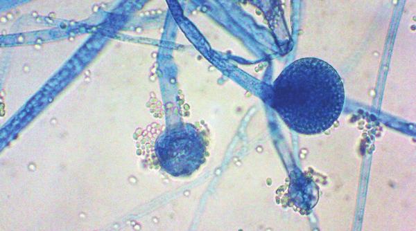 India lovită de o altă boală cumplită. Afectați, pacienții vindecați de COVID-19