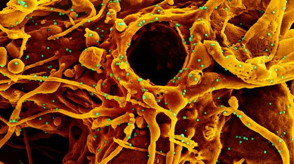 Cât durează imunitatea după COVID-19. Veștile sunt bune