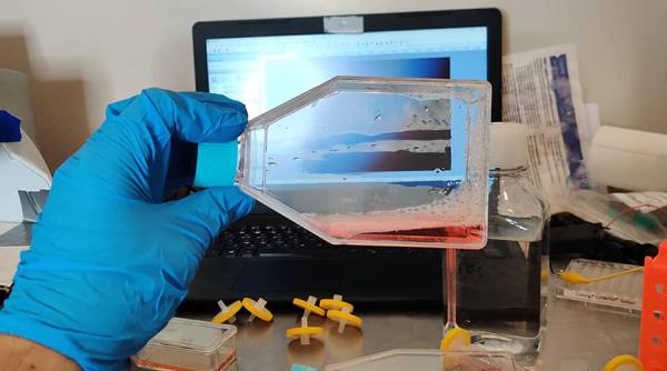 Covid-19. Vaccinul din ”bucătărie”. Concluziile unui biohacker