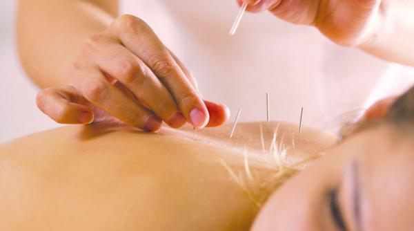 (P) Acupunctura: ce trebuie să știi despre această procedura antică de tratament