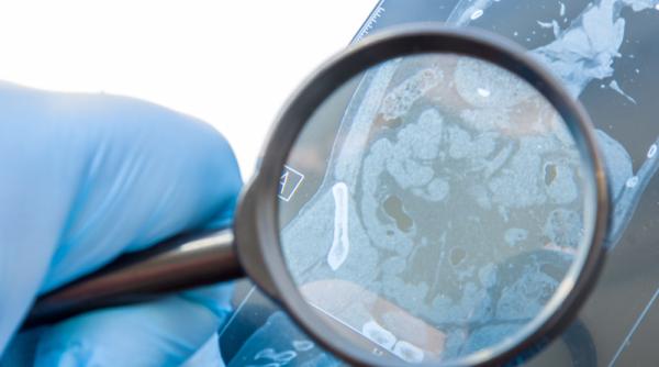 Rolul RMN-ului în monitorizarea afecțiunilor cronice